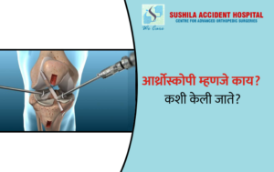 आर्थ्रोस्कोपी म्हणजे काय? कशी केली जाते?