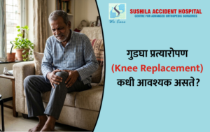 गुडघा प्रत्यारोपण (Knee Replacement) कधी आवश्यक असते?