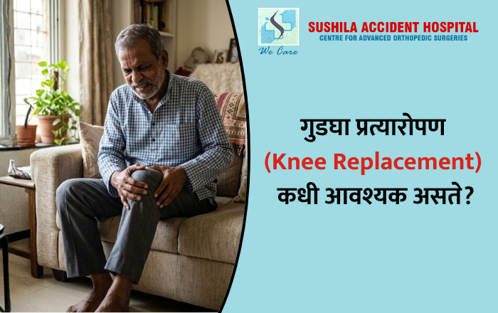 गुडघा प्रत्यारोपण (Knee Replacement) कधी आवश्यक असते?